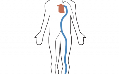 Pulse Wave Velocity: A Key to Slowing Biological Aging