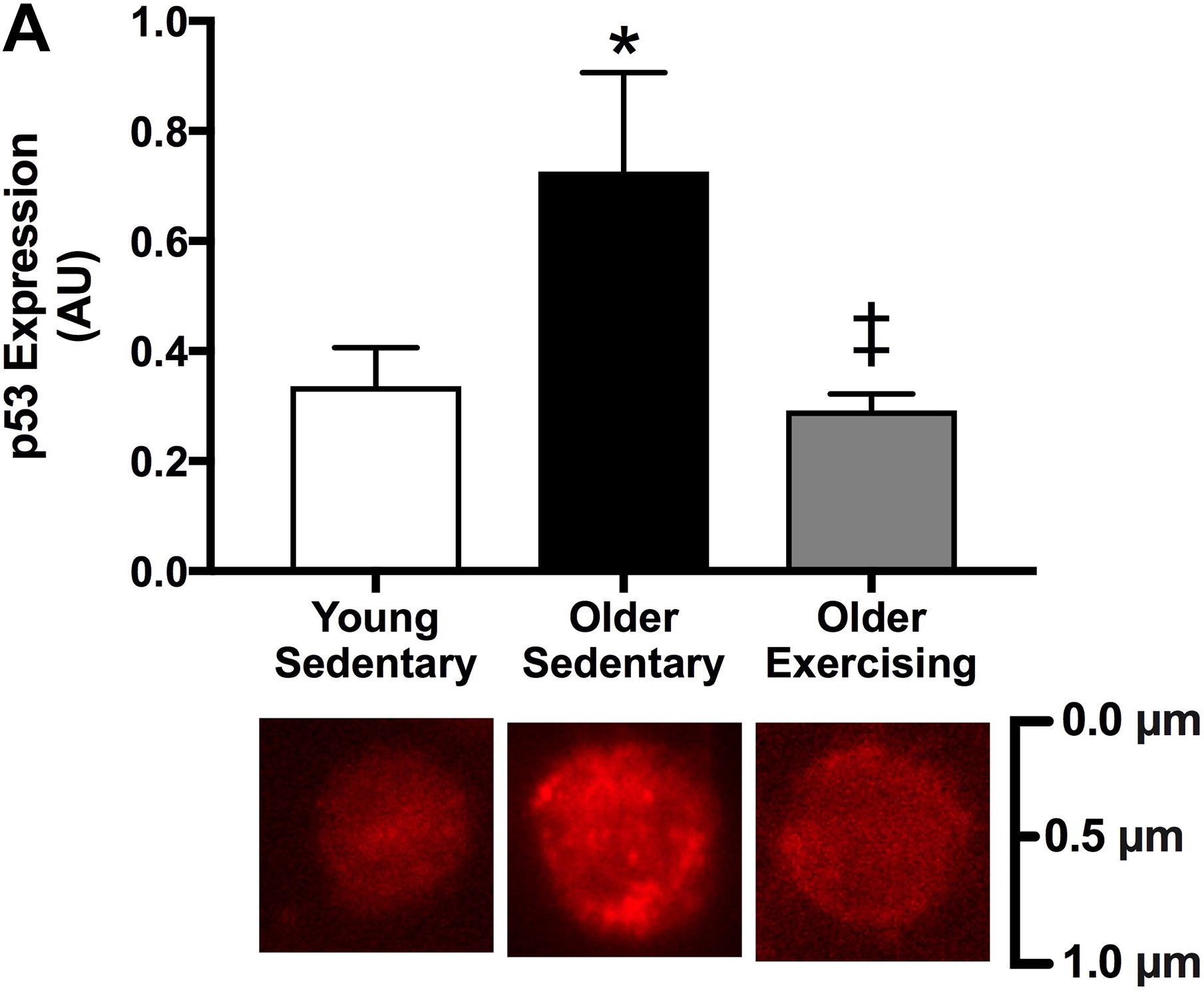 p53 expression